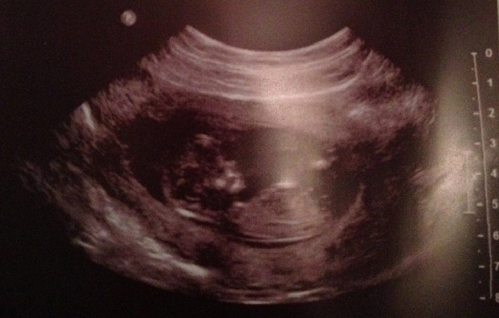 12 week ultrasound, showing a side profile of a baby. :) :)